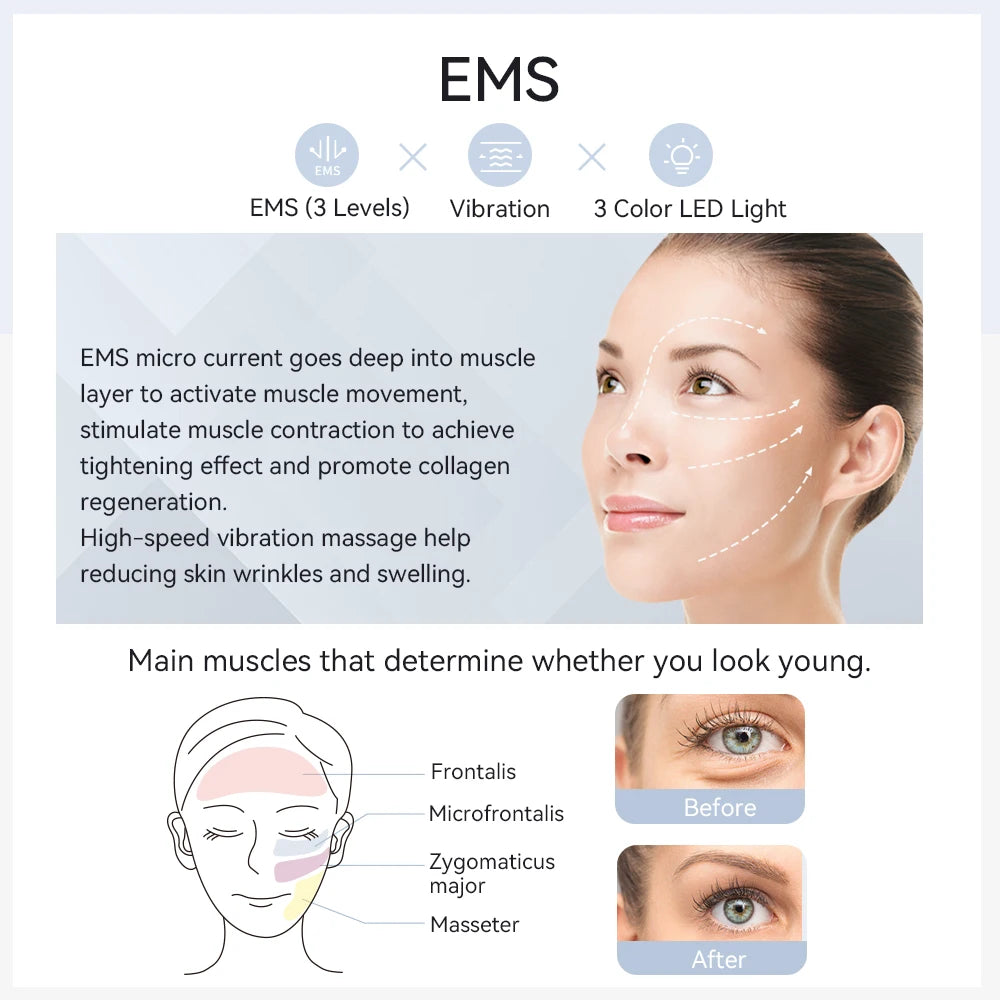 ANLAN EMS Facial Massager Pro Face Lifting Skin Rejuvenation Cold Compress Deep Cleaning Anti-aging Skincare Beauty Device - Limetastore