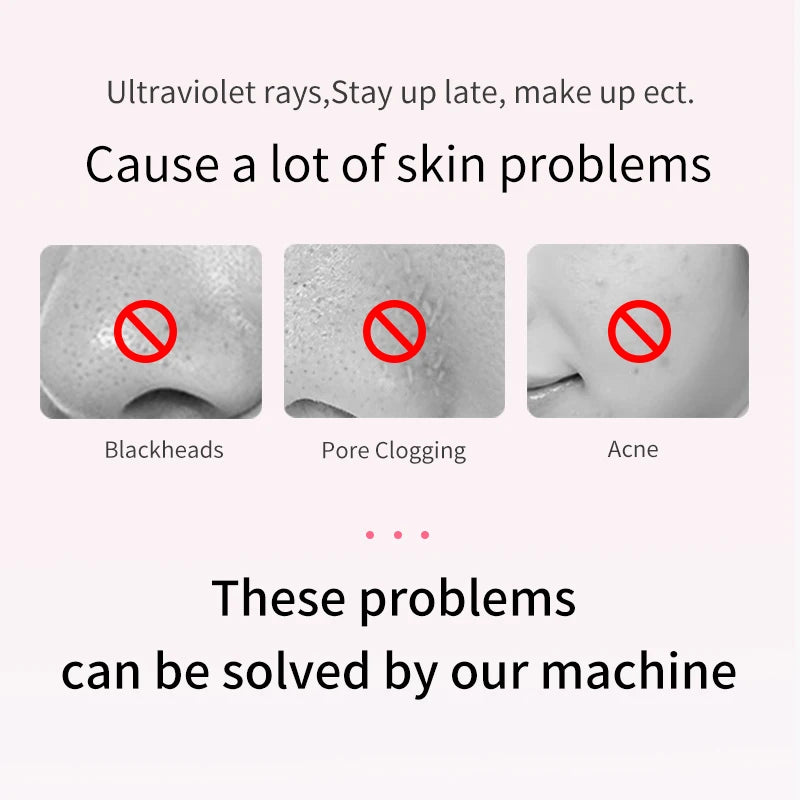 ANLAN Ultrasonic Skin Scrubber - Deep Cleaning Peeling Shovel for Facial Care and Skin Lifting - Ultrasonic Cleaner for Radiant Skin - Limetastore