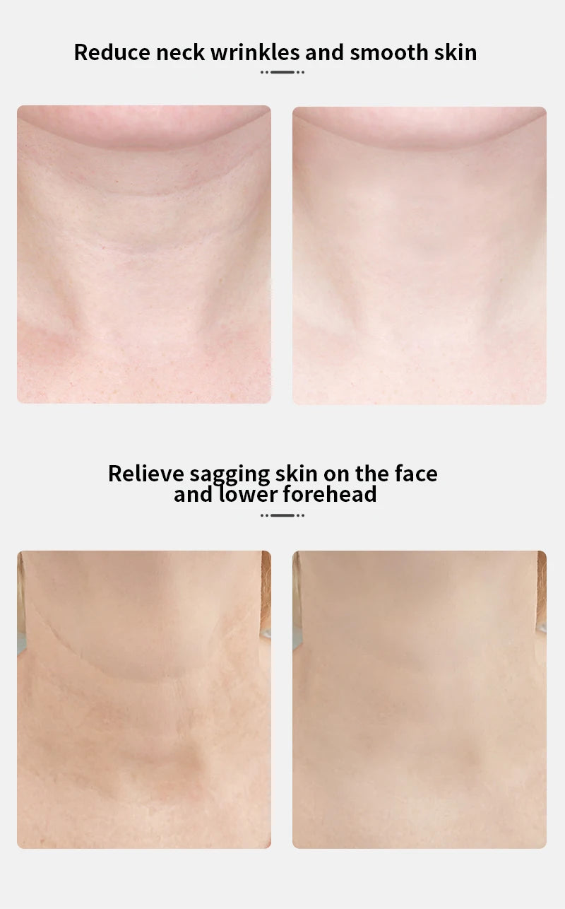 ANLAN Neck Lifting Beauty Device – EMS Facial Neck Tightening, 3 Colors Light Skin Care Tool to Reduce Double Chin - Limetastore