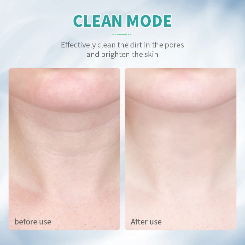 ANLAN Neck & Face Beauty Device | EMS Lifting, 3‑Color Light, Double‑Chin Reduction