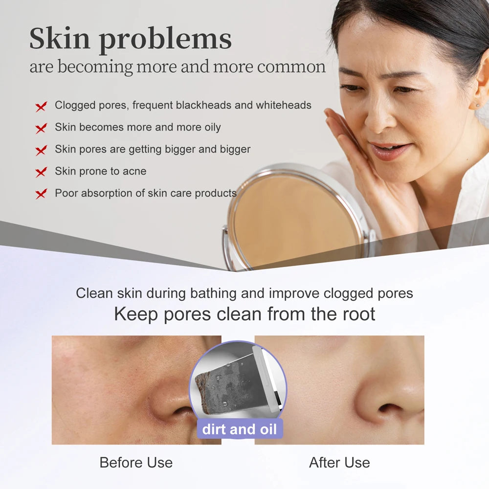 ANLAN Ultrasonic Skin Scrubber Peeling Facial Ultrasonic EMS Facial Lifting Red Blue Skin Care Pore Deep Cleansing Machine IPX7 - Limetastore