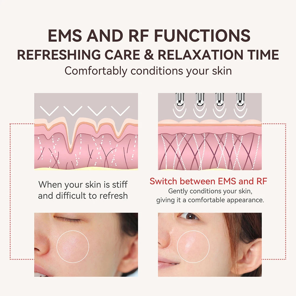 ANLAN RF Acupoint Massager | Dual‑Head RF+EMS, Skin Firming, Fatigue Relief