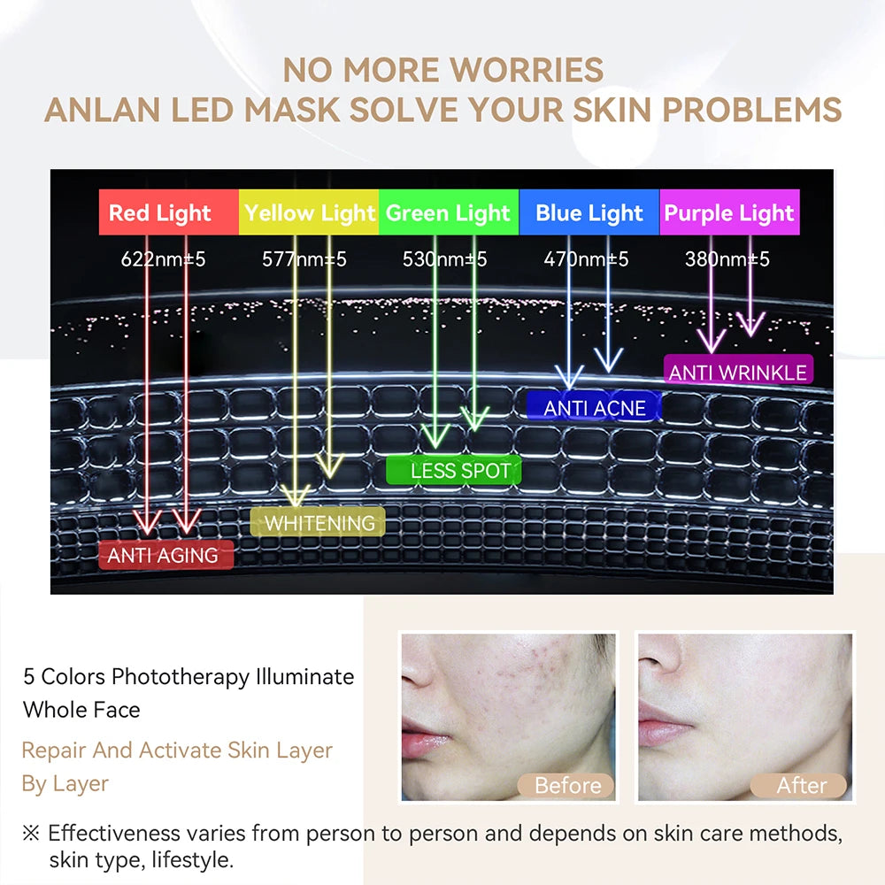 ANLAN LED Facial Mask - 5 Color Silicone Waterproof Thermotherapy for Anti-Aging, Skin Rejuvenation, and Brightening - Limetastore