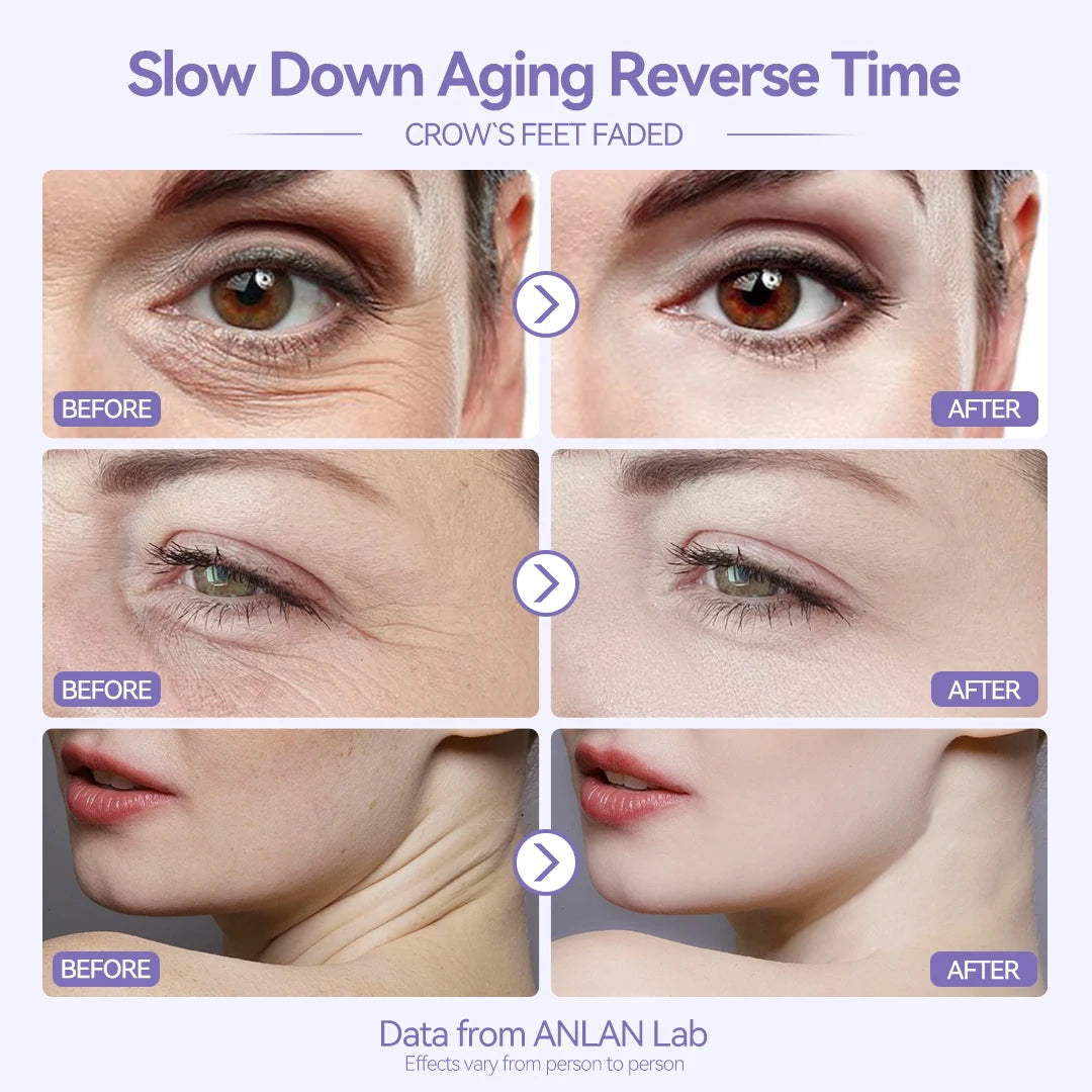 ANLAN EMS Facial Massager | LED Photon, Deep Cleaning, Heat & Vibration