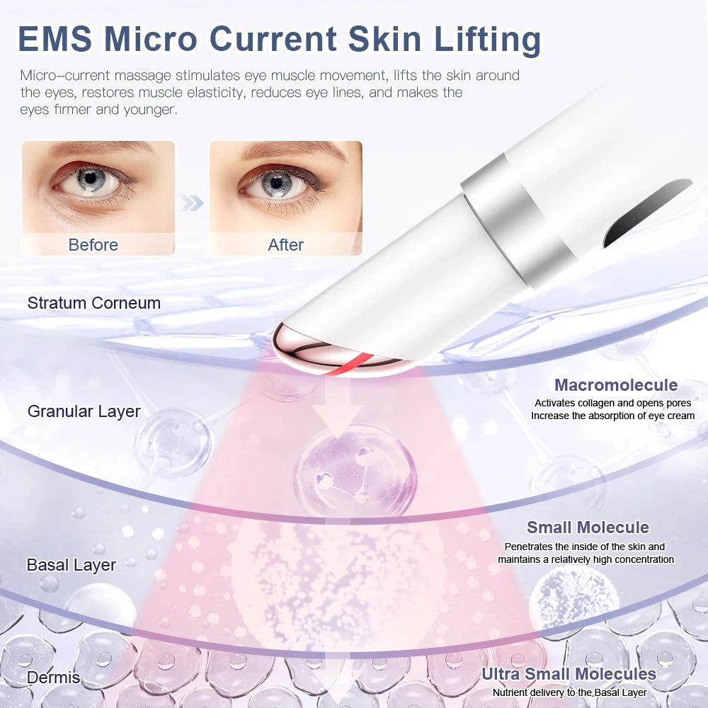 ANLAN Electric Eye Massager for Dark Circles and Eye Bags with Vibration and Heat Therapy - Limetastore